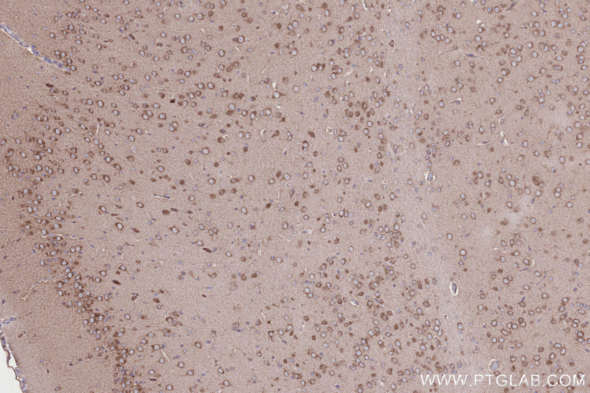 Immunohistochemical analysis of paraffin-embedded rat brain tissue slide using KHC2664 (ABI1 IHC Kit).