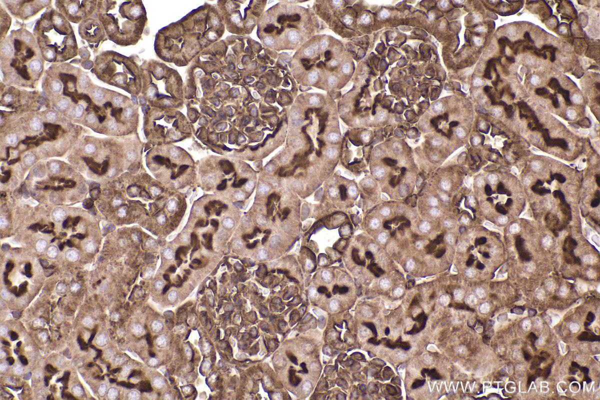 Immunohistochemical analysis of paraffin-embedded mouse kidney tissue slide using KHC2345 (ACTB IHC Kit).