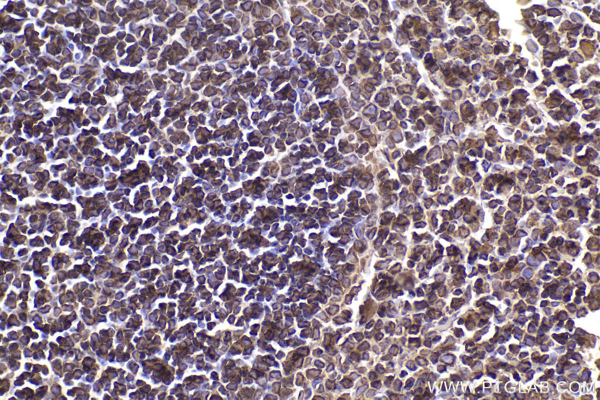 Immunohistochemical analysis of paraffin-embedded mouse spleen tissue slide using KHC2345 (ACTB IHC Kit).