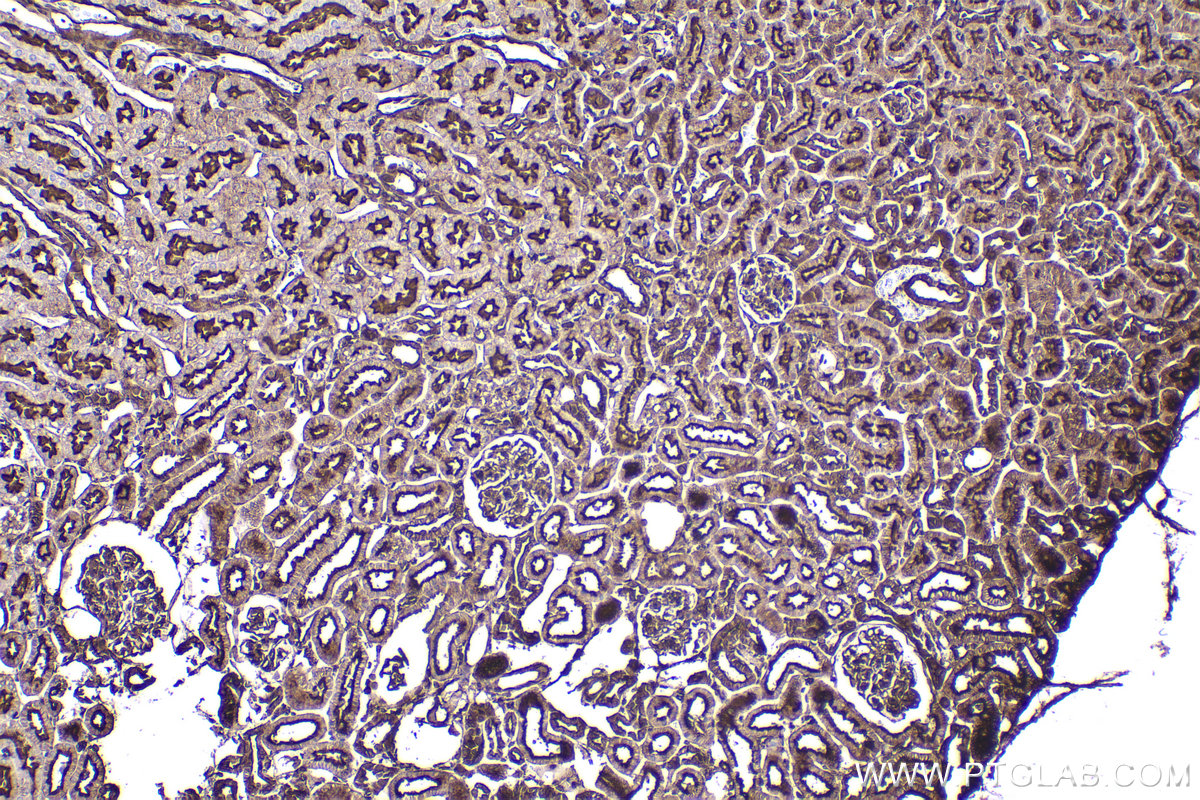 Immunohistochemical analysis of paraffin-embedded rat kidney tissue slide using KHC2345 (ACTB IHC Kit).