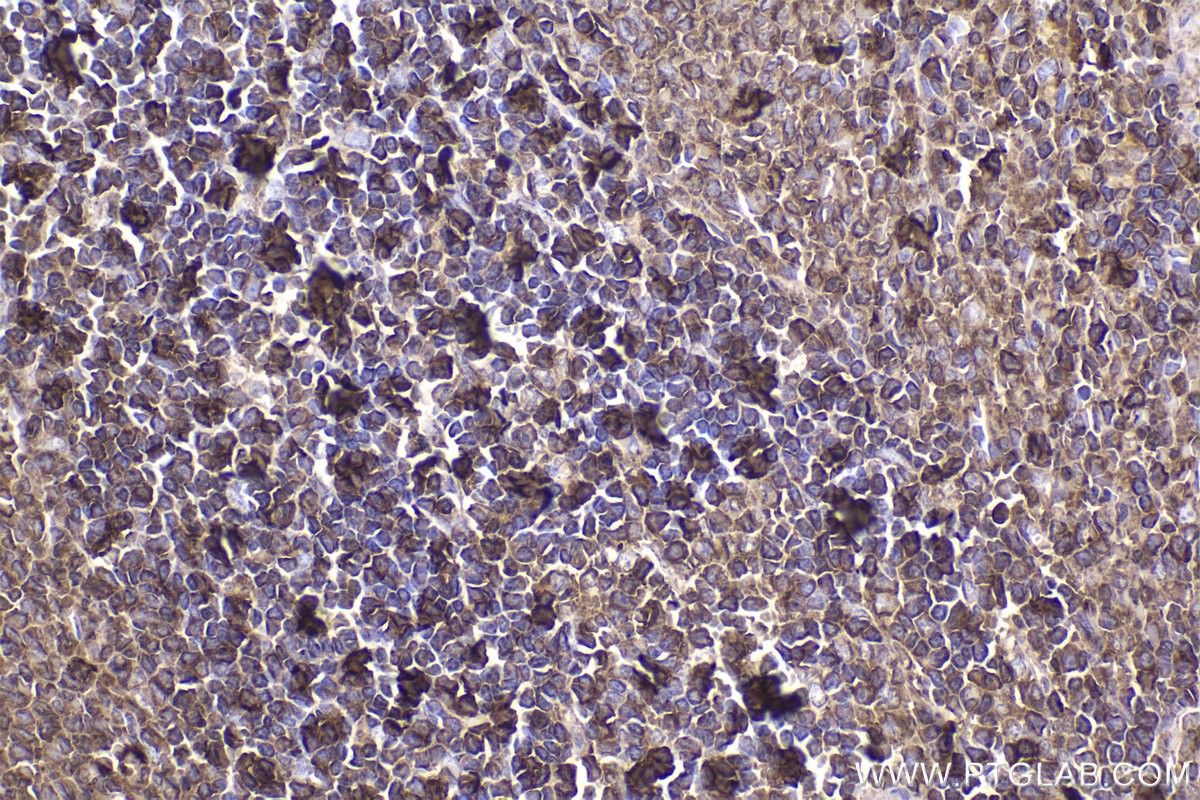 Immunohistochemical analysis of paraffin-embedded rat spleen tissue slide using KHC2345 (ACTB IHC Kit).