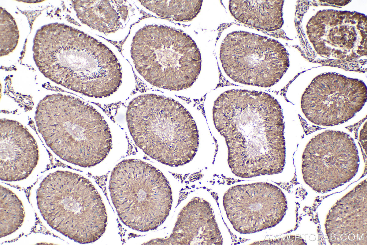 Immunohistochemical analysis of paraffin-embedded rat testis tissue slide using KHC2393 (ACVR1 IHC Kit).