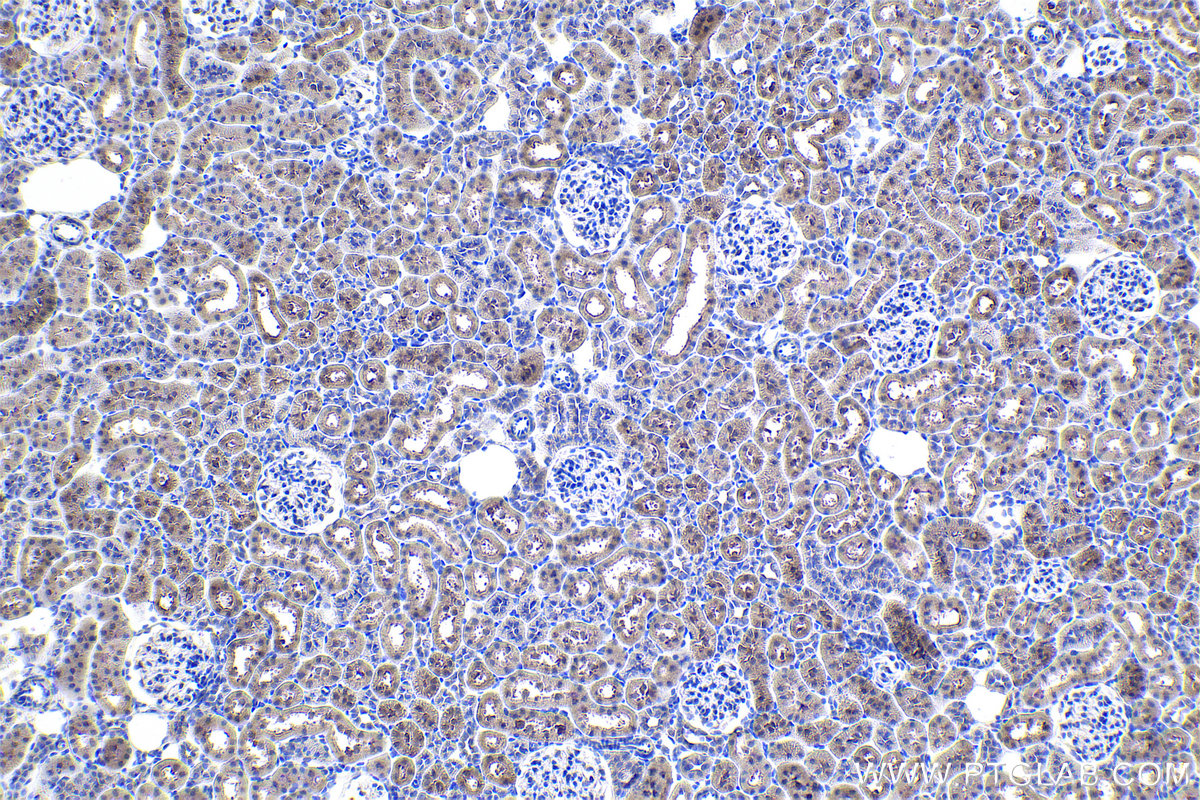 Immunohistochemical analysis of paraffin-embedded rat kidney tissue slide using KHC1042 (ACY1 IHC Kit).