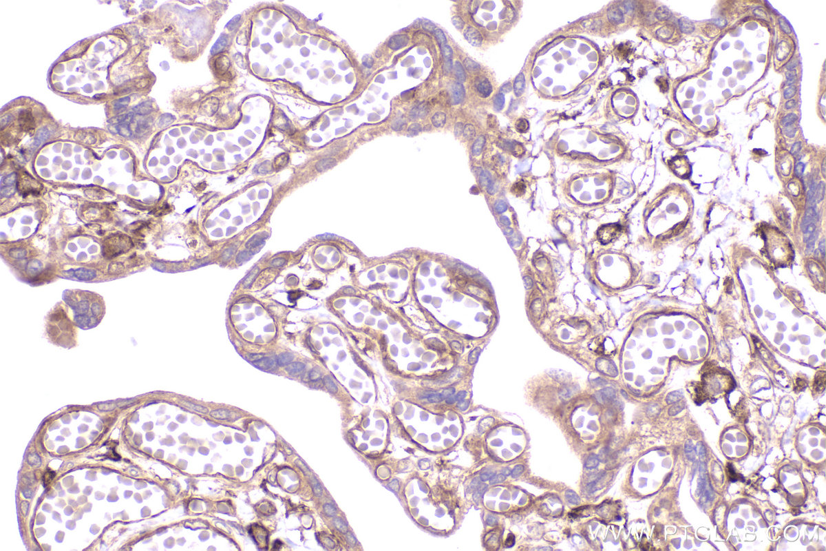 Immunohistochemical analysis of paraffin-embedded human placenta tissue slide using KHC2366 (ADAM17 IHC Kit).