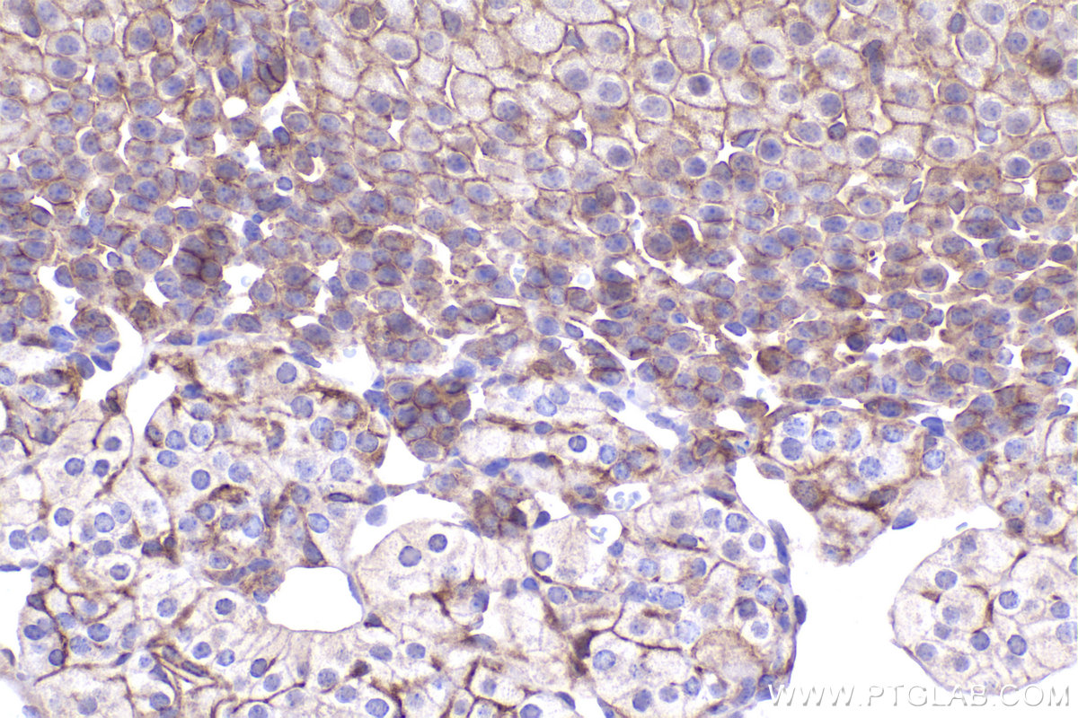 Immunohistochemical analysis of paraffin-embedded mouse adrenal gland tissue slide using KHC2366 (ADAM17 IHC Kit).