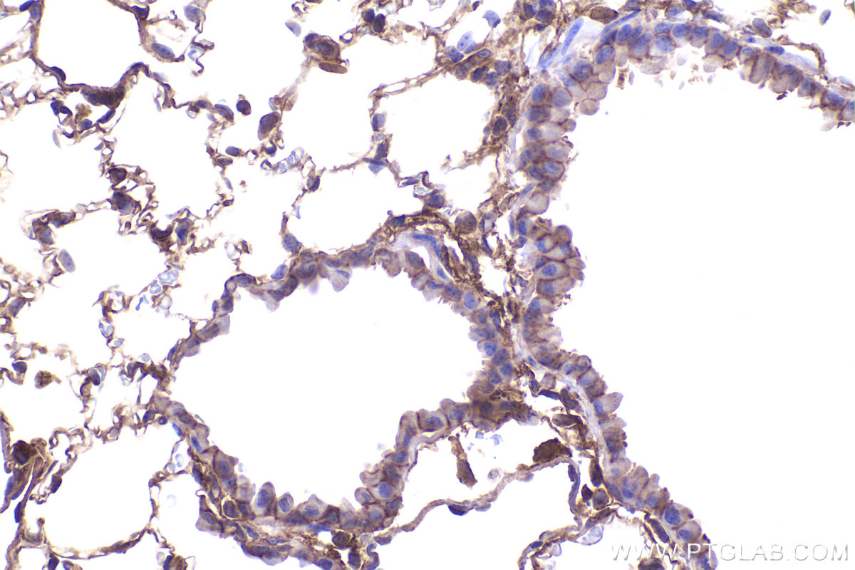 Immunohistochemical analysis of paraffin-embedded mouse lung tissue slide using KHC2366 (ADAM17 IHC Kit).