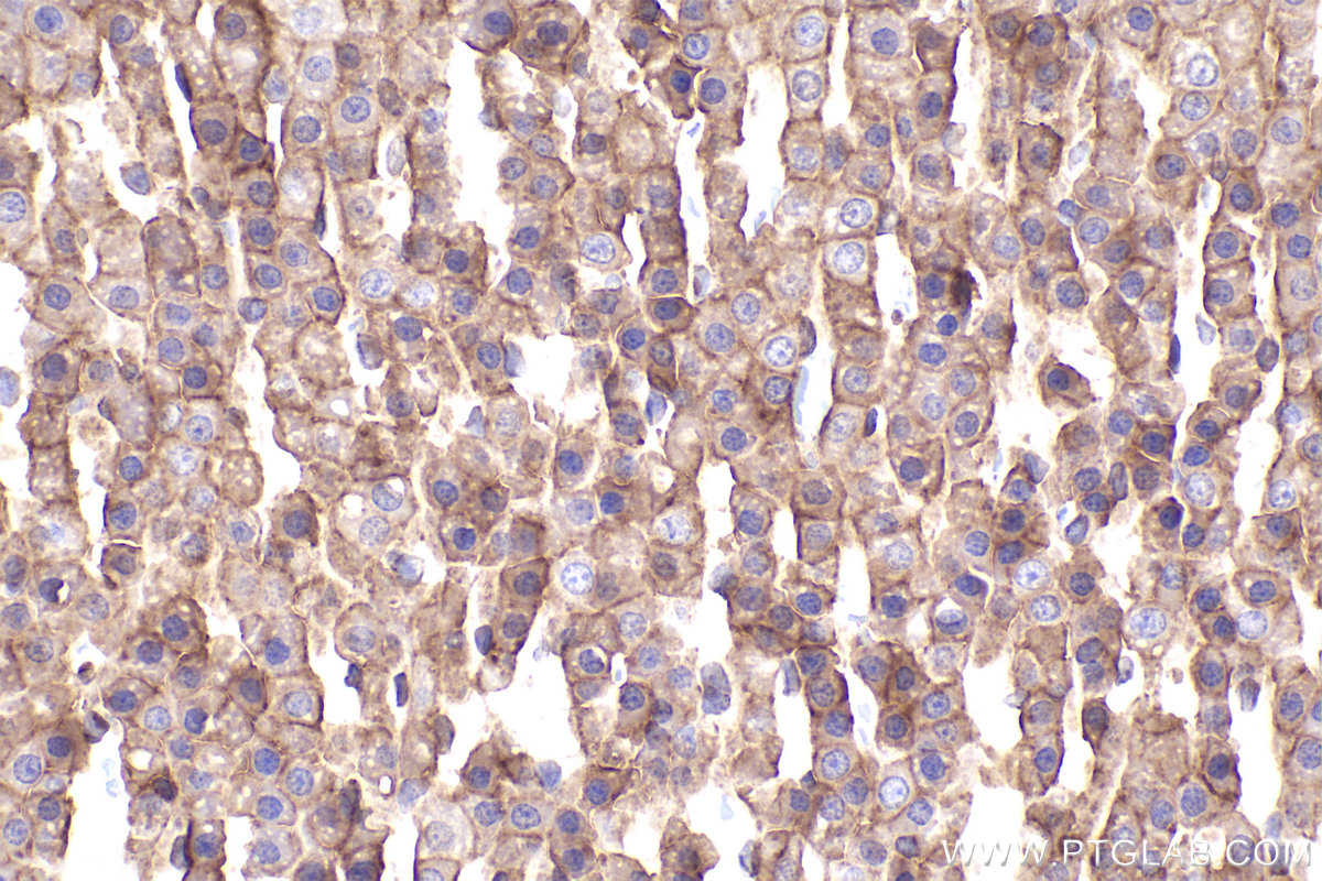 Immunohistochemical analysis of paraffin-embedded rat adrenal gland tissue slide using KHC2366 (ADAM17 IHC Kit).