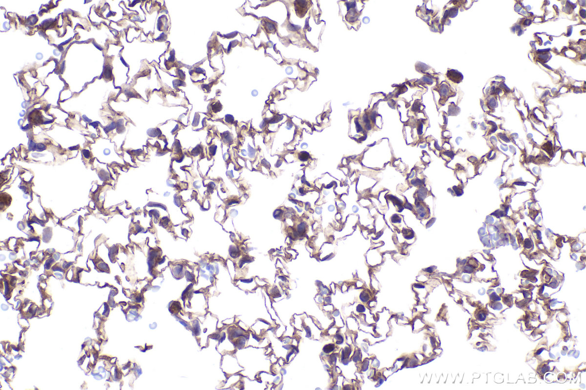 Immunohistochemical analysis of paraffin-embedded rat lung tissue slide using KHC2366 (ADAM17 IHC Kit).