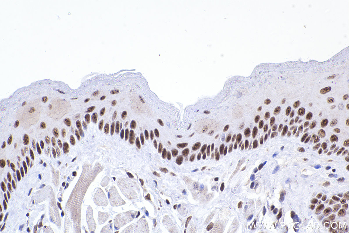 Immunohistochemical analysis of paraffin-embedded mouse tongue tissue slide using KHC2368 (ADARB1 IHC Kit).