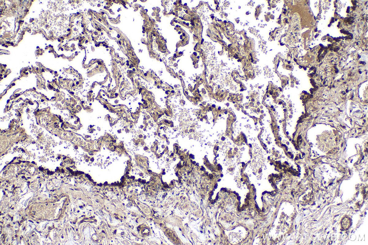 Immunohistochemical analysis of paraffin-embedded human lung tissue slide using KHC2154 (AK1 IHC Kit).