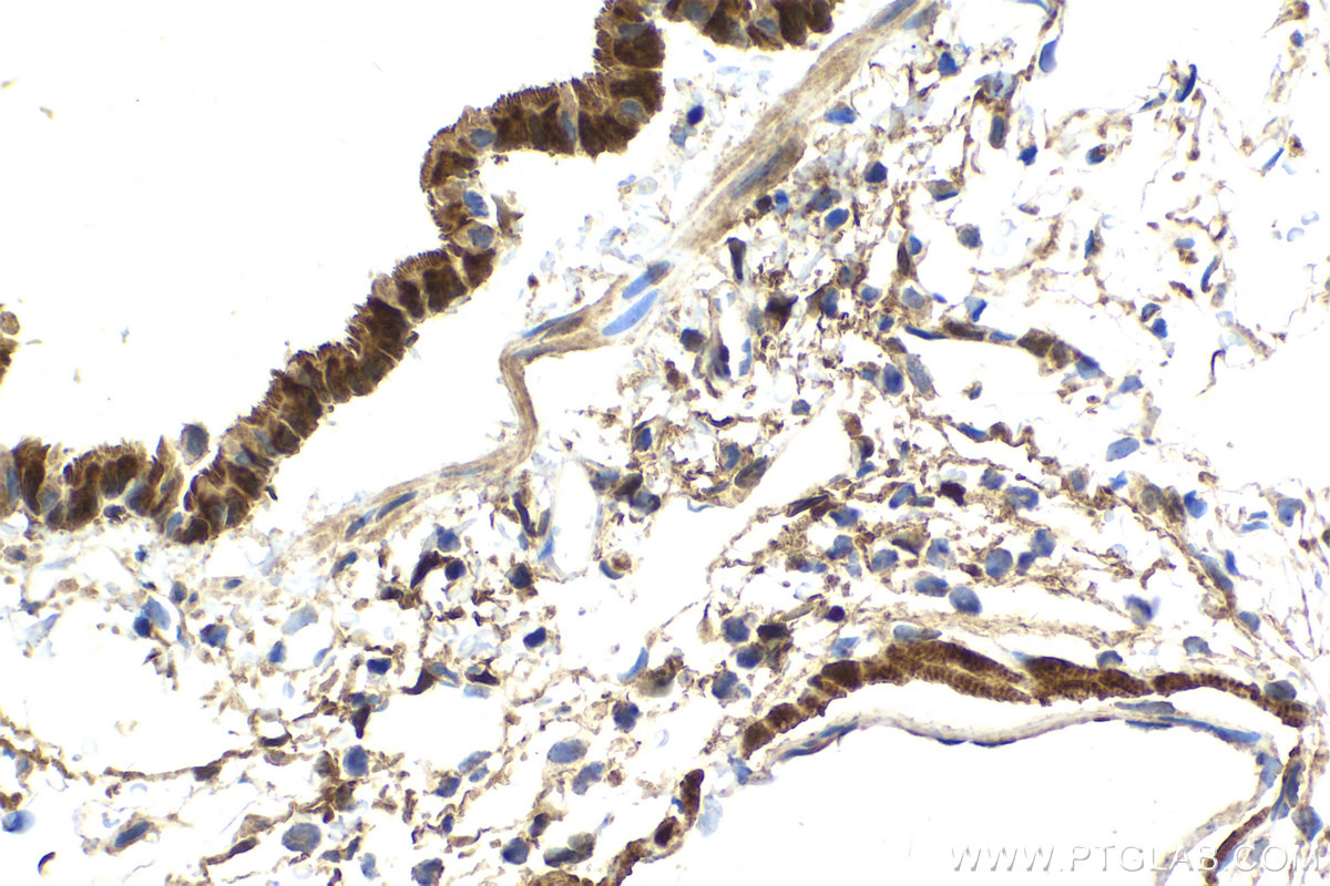 Immunohistochemical analysis of paraffin-embedded rat lung tissue slide using KHC2154 (AK1 IHC Kit).