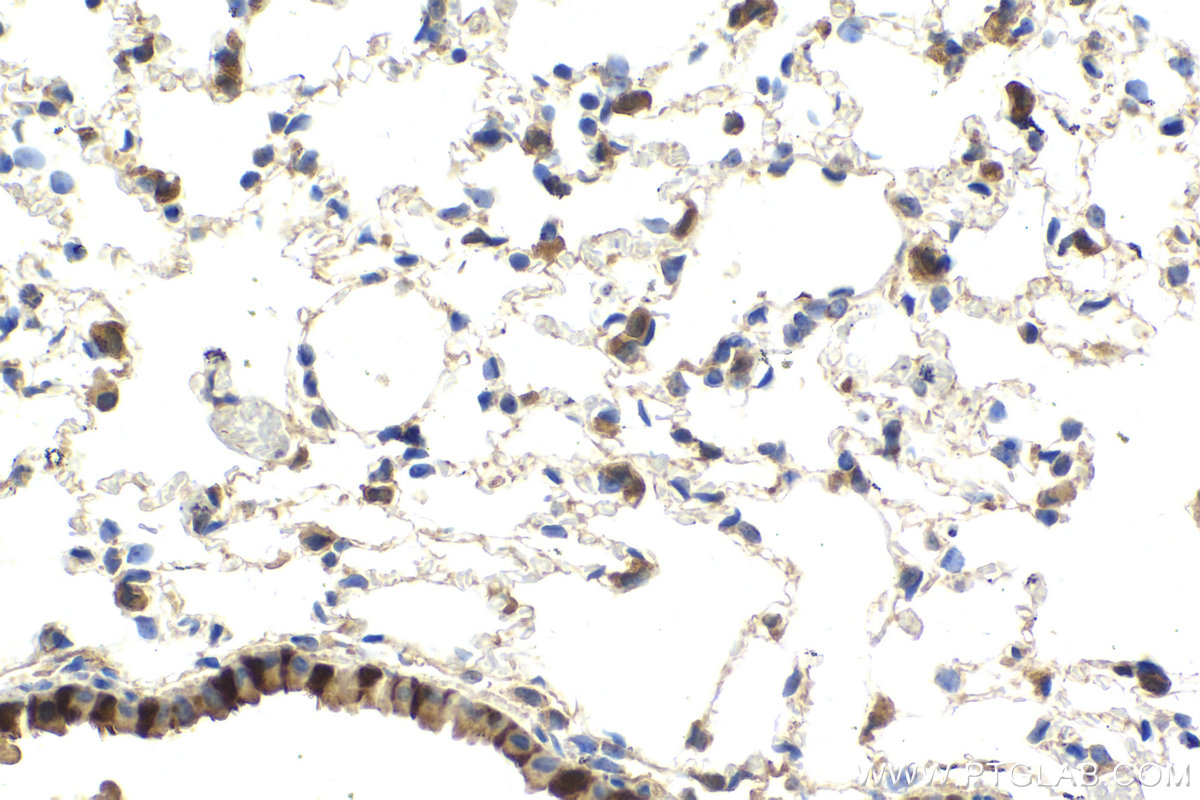 Immunohistochemical analysis of paraffin-embedded mouse lung tissue slide using KHC2154 (AK1 IHC Kit).