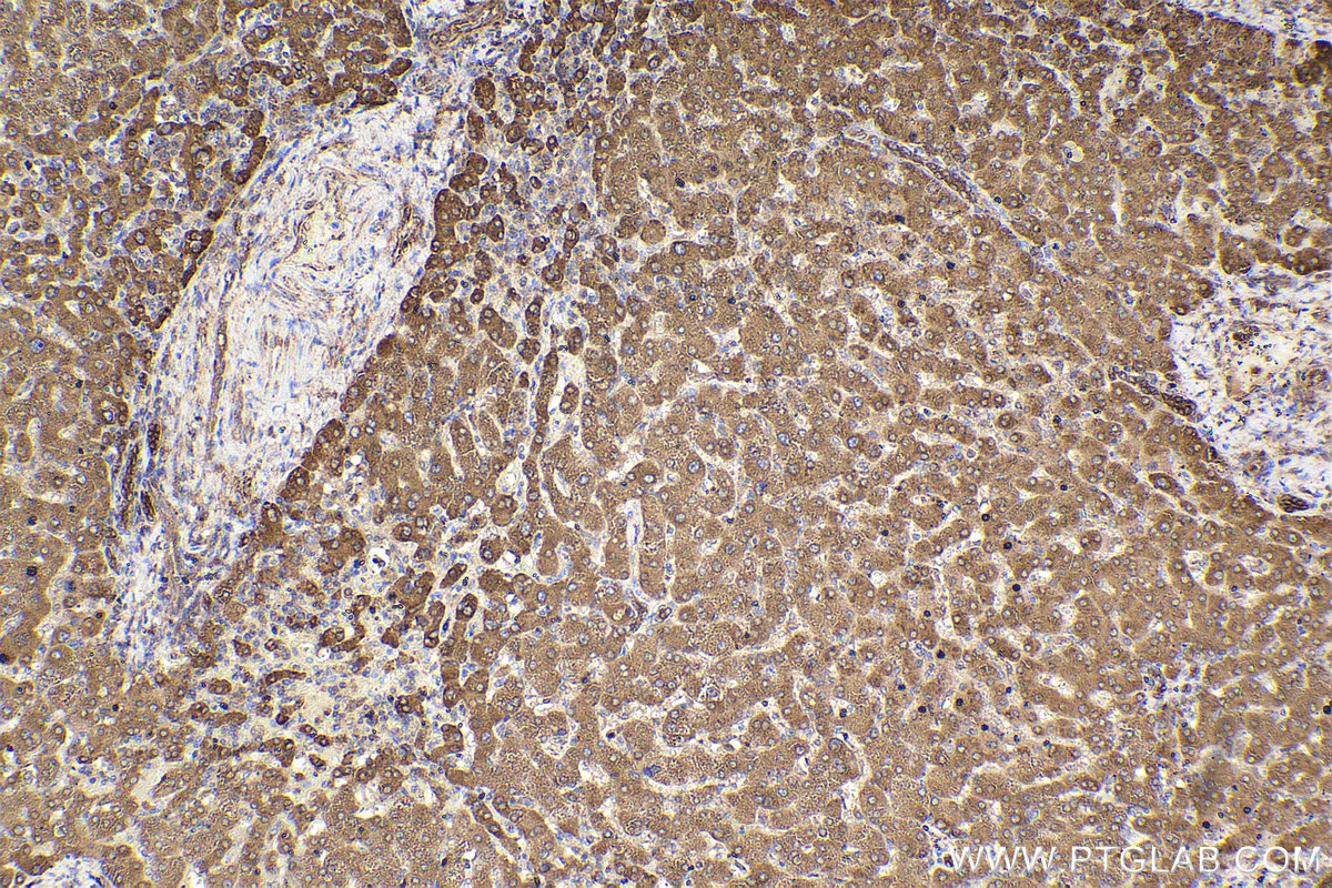 Immunohistochemical analysis of paraffin-embedded human liver tissue slide using KHC2305 (ALDH3A2 IHC Kit).