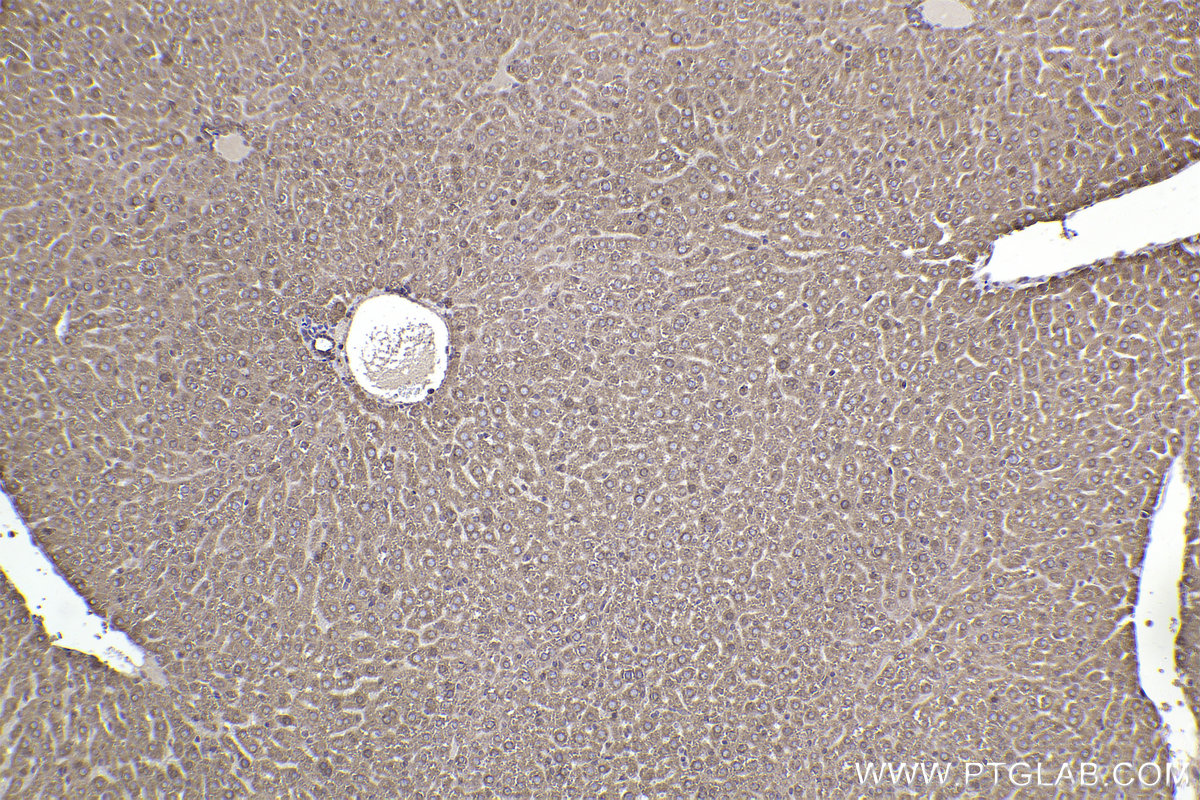 Immunohistochemical analysis of paraffin-embedded mouse liver tissue slide using KHC2305 (ALDH3A2 IHC Kit).