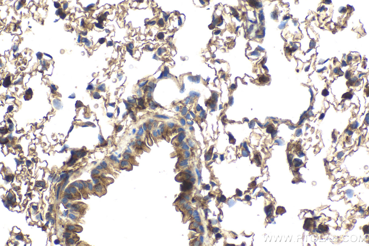 Immunohistochemical analysis of paraffin-embedded rat lung tissue slide using KHC2160 (ALPL IHC Kit).