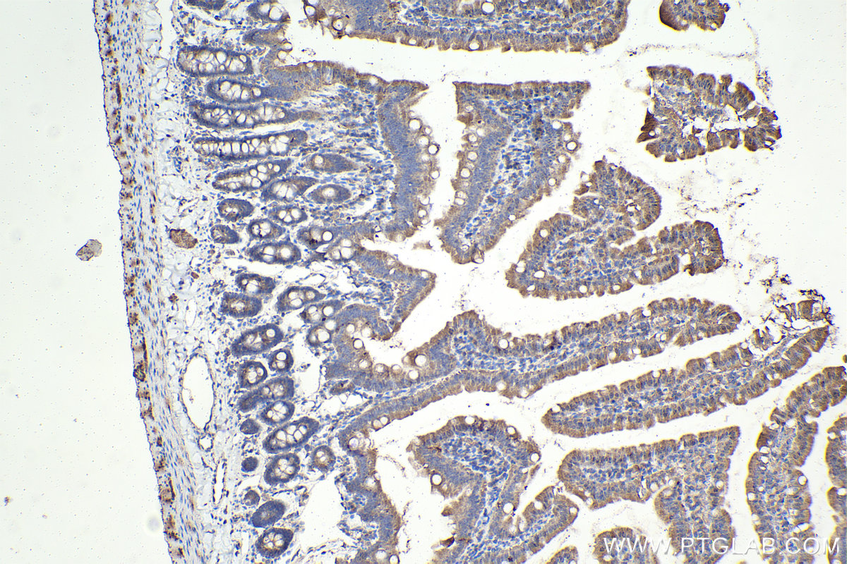 Immunohistochemical analysis of paraffin-embedded rat small intestine tissue slide using KHC2382 (AMPD2 IHC Kit).