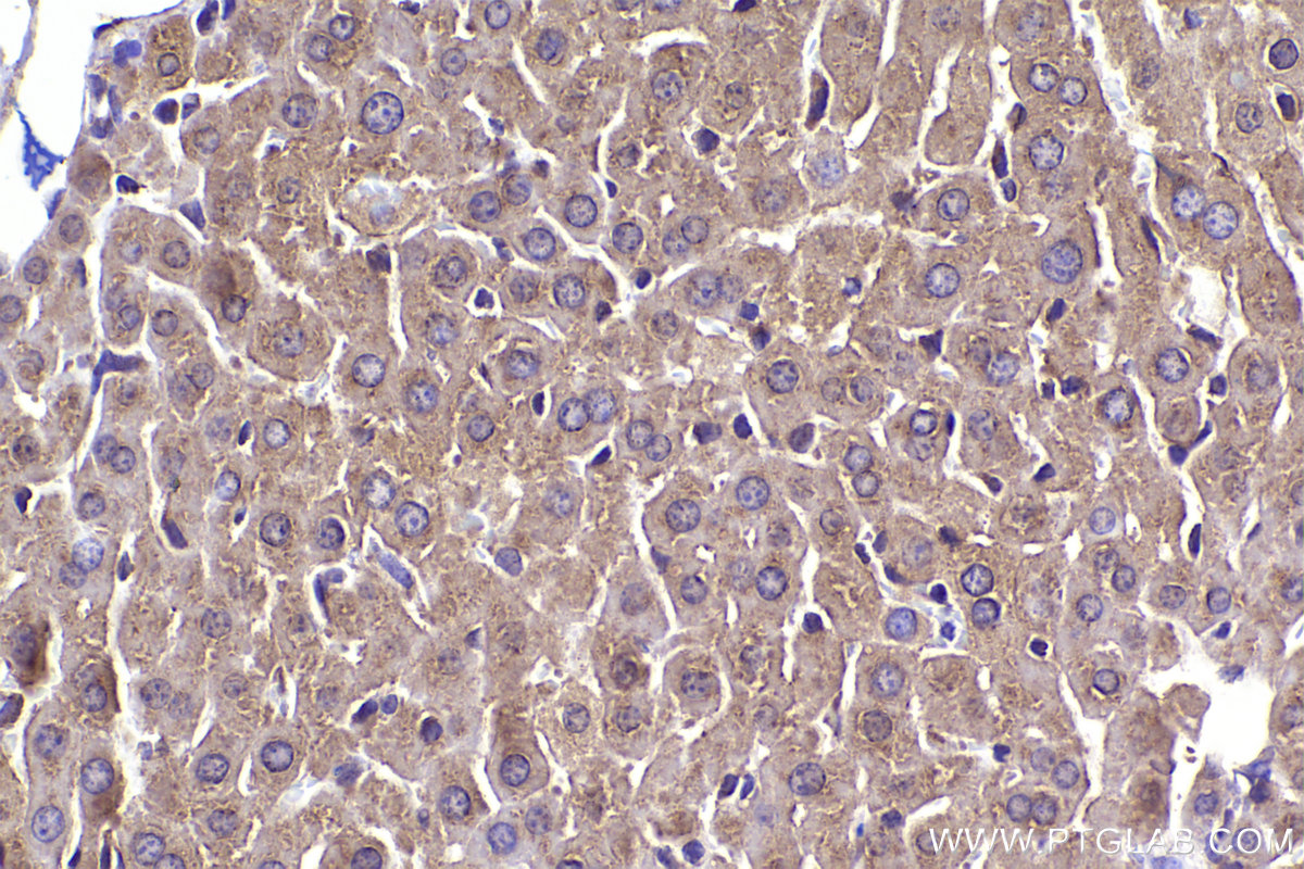 Immunohistochemical analysis of paraffin-embedded mouse liver tissue slide using KHC2333 (ANTXR2 IHC Kit).