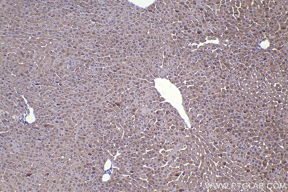 Immunohistochemical analysis of paraffin-embedded rat liver tissue slide using KHC2333 (ANTXR2 IHC Kit).