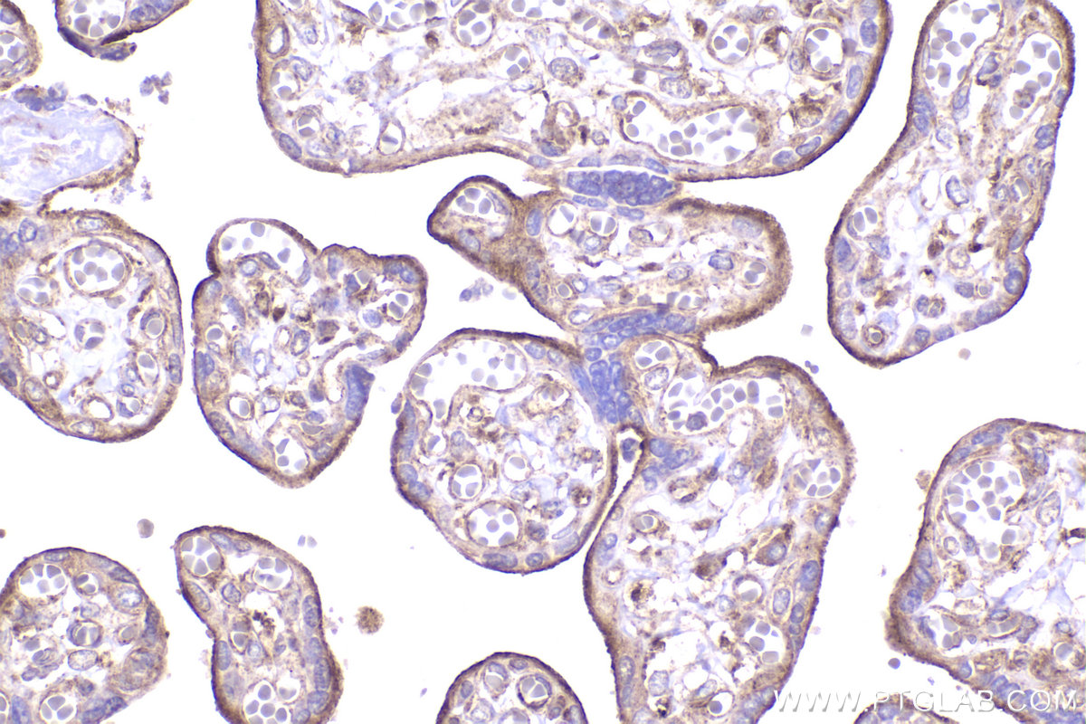 Immunohistochemical analysis of paraffin-embedded human placenta tissue slide using KHC2357 (AP2B1 IHC Kit).