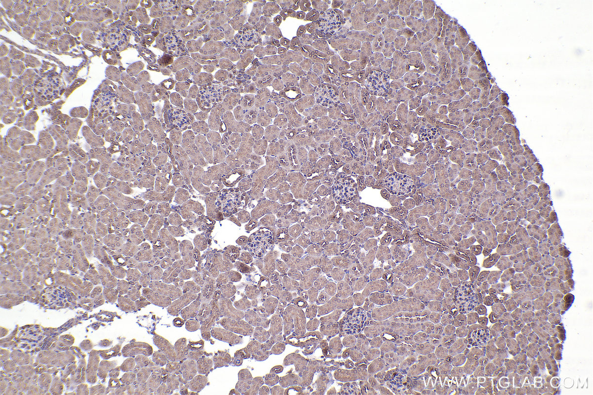 Immunohistochemical analysis of paraffin-embedded mouse kidney tissue slide using KHC2350 (ARF6 IHC Kit).