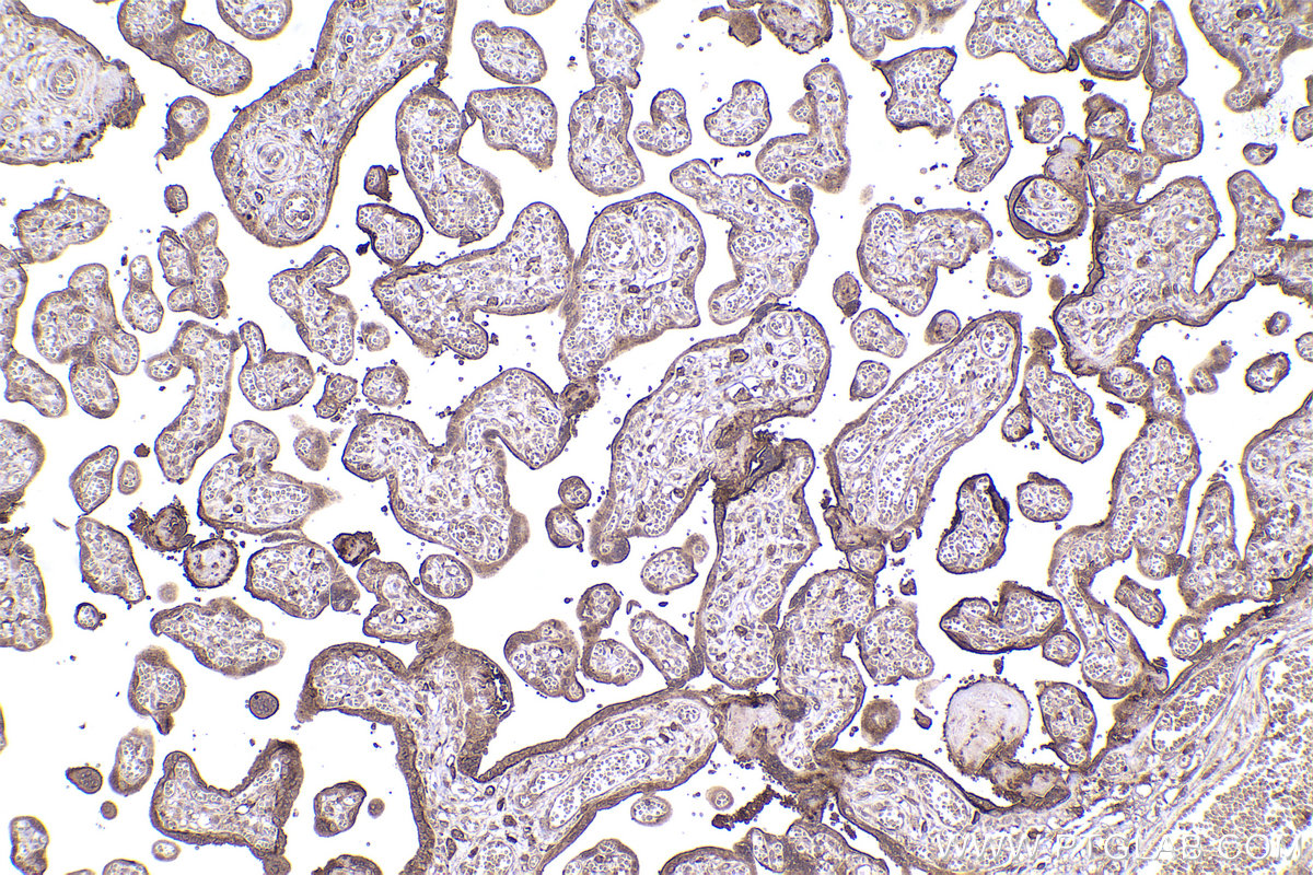 Immunohistochemical analysis of paraffin-embedded human placenta tissue slide using KHC2350 (ARF6 IHC Kit).