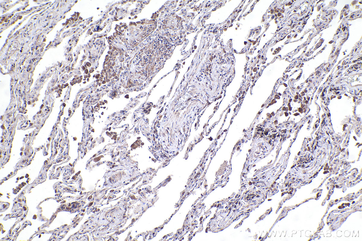 Immunohistochemical analysis of paraffin-embedded human lung tissue slide using KHC2367 (ARG2 IHC Kit).