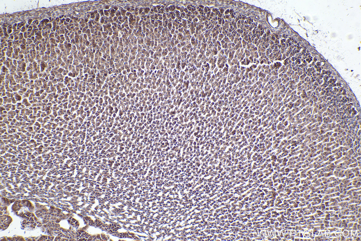 Immunohistochemical analysis of paraffin-embedded rat adrenal gland tissue slide using KHC2555 (ARHGAP21 IHC Kit).