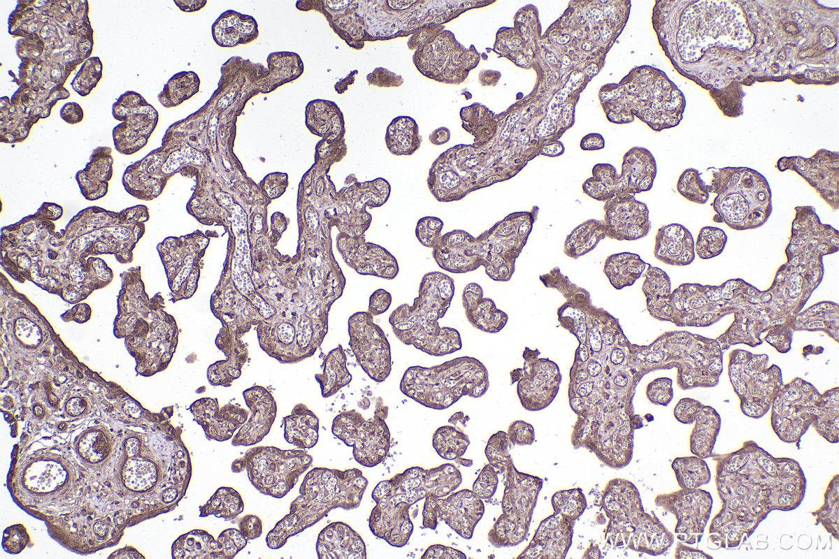 Immunohistochemical analysis of paraffin-embedded human placenta tissue slide using KHC2555 (ARHGAP21 IHC Kit).