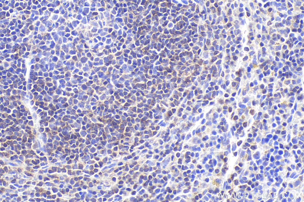 Immunohistochemical analysis of paraffin-embedded mouse spleen tissue slide using KHC2405 (ARHGAP4 IHC Kit).