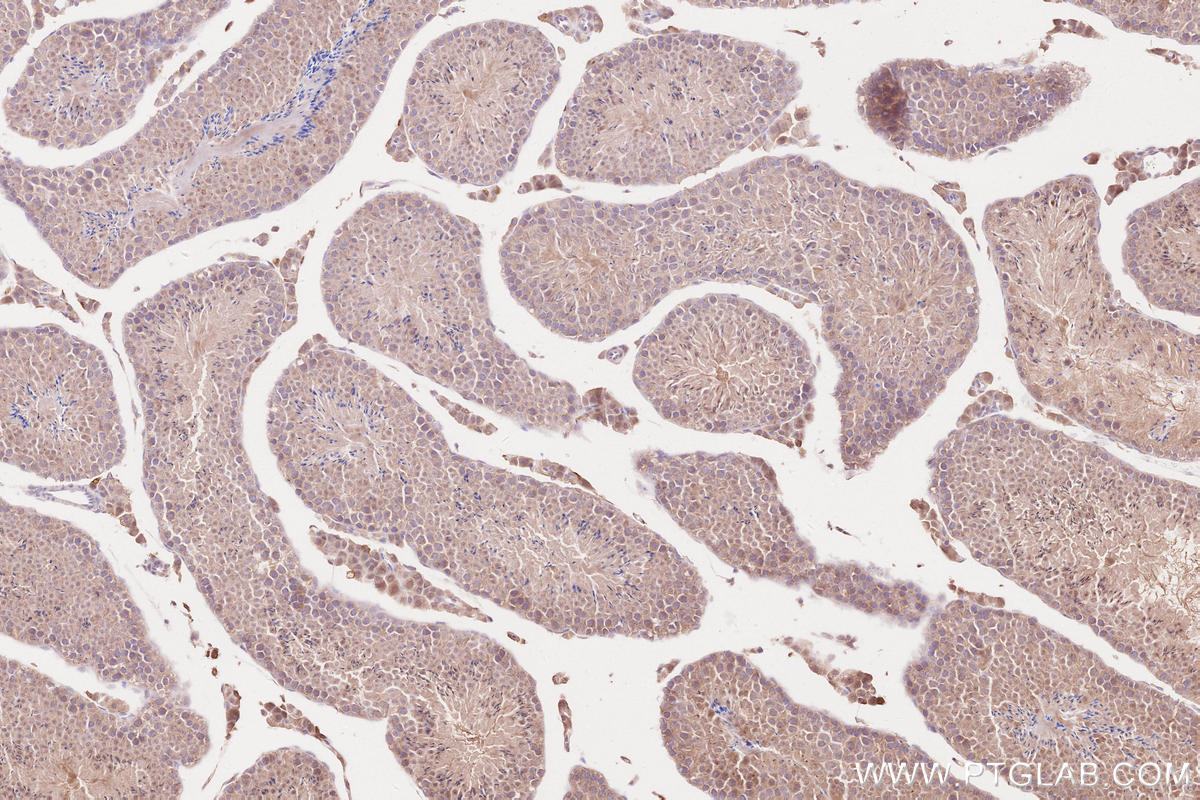 Immunohistochemical analysis of paraffin-embedded mouse testis tissue slide using KHC2605 (ARHGEF18 IHC Kit).