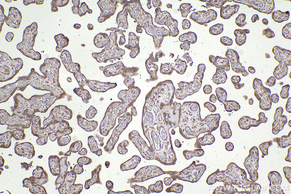 Immunohistochemical analysis of paraffin-embedded human placenta tissue slide using KHC2449 (ARHGEF7 IHC Kit).