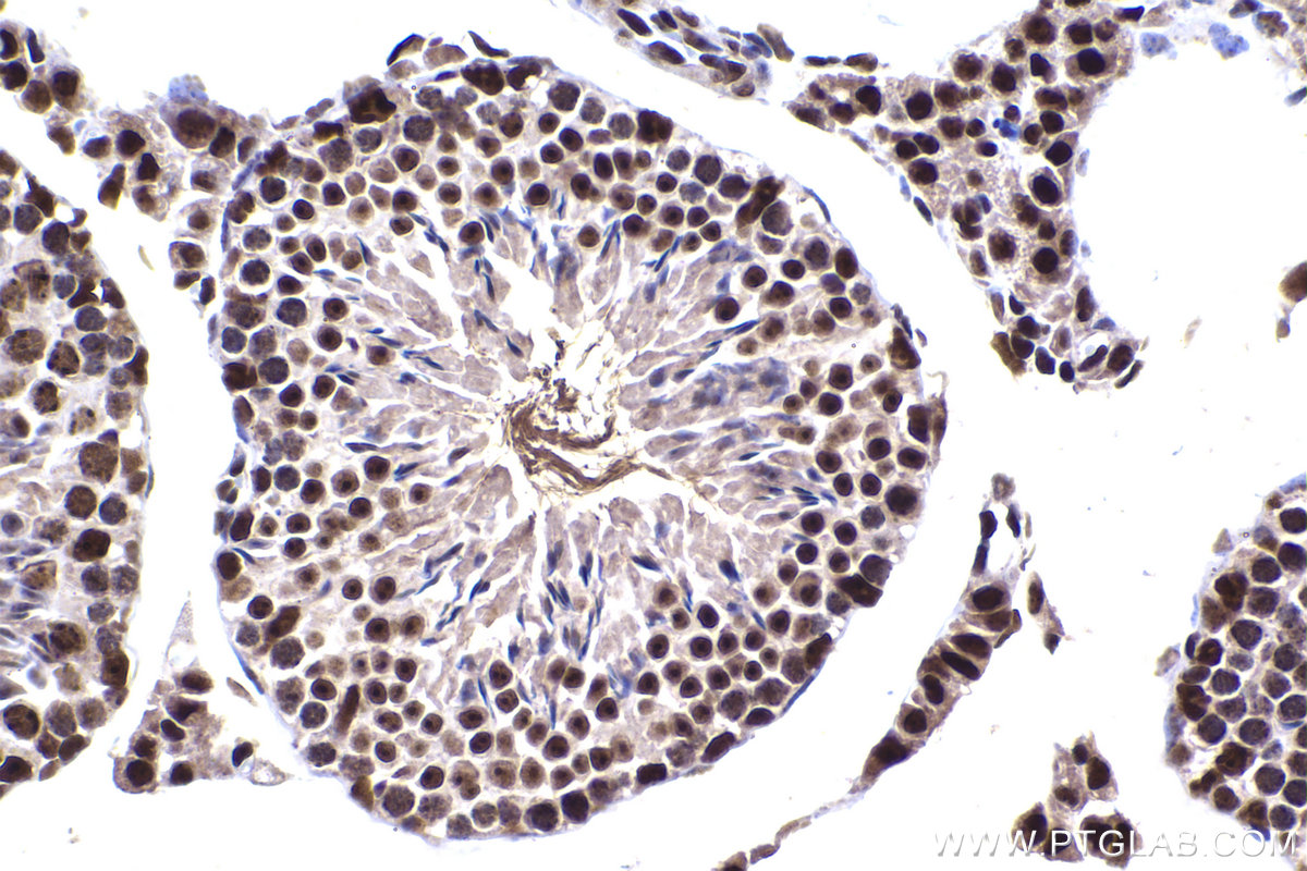 Immunohistochemical analysis of paraffin-embedded mouse testis tissue slide using KHC2250 (ARL2 IHC Kit).