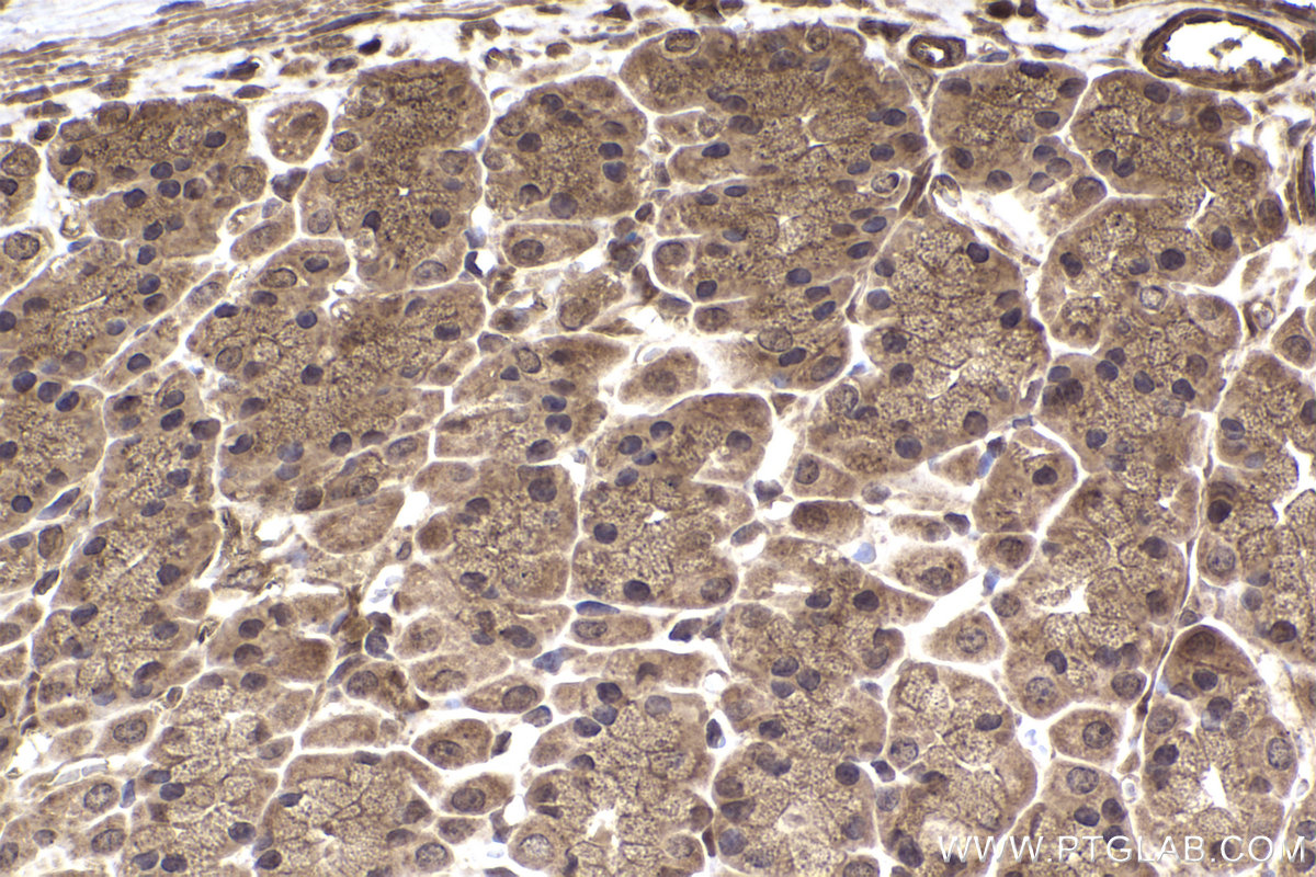 Immunohistochemical analysis of paraffin-embedded rat stomach tissue slide using KHC2251 (ARL3 IHC Kit).