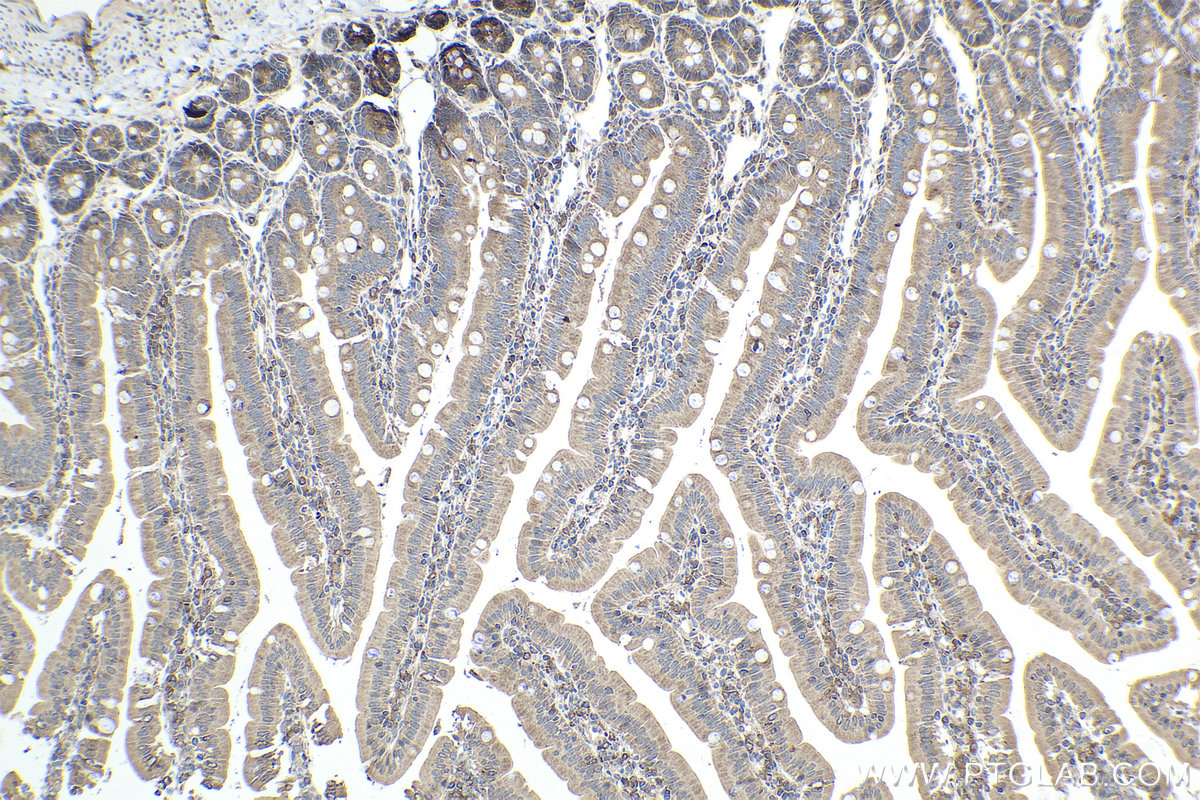 Immunohistochemical analysis of paraffin-embedded rat small intestine tissue slide using KHC1636 (ARPC4 IHC Kit).