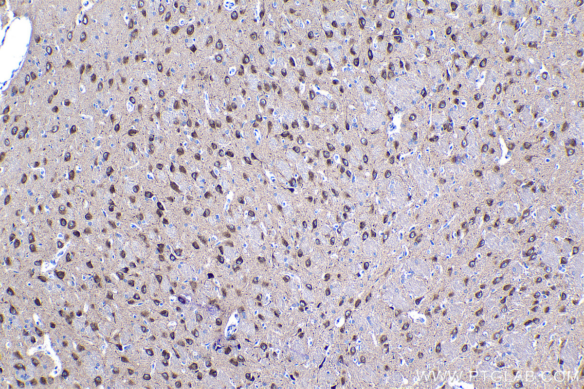 Immunohistochemical analysis of paraffin-embedded rat brain tissue slide using KHC1234 (ASPH IHC Kit).