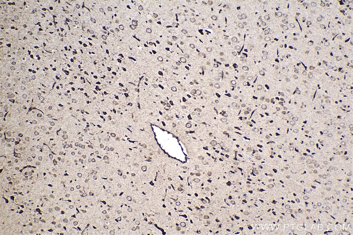 Immunohistochemical analysis of paraffin-embedded rat brain tissue slide using KHC1553 (ATF7 IHC Kit).