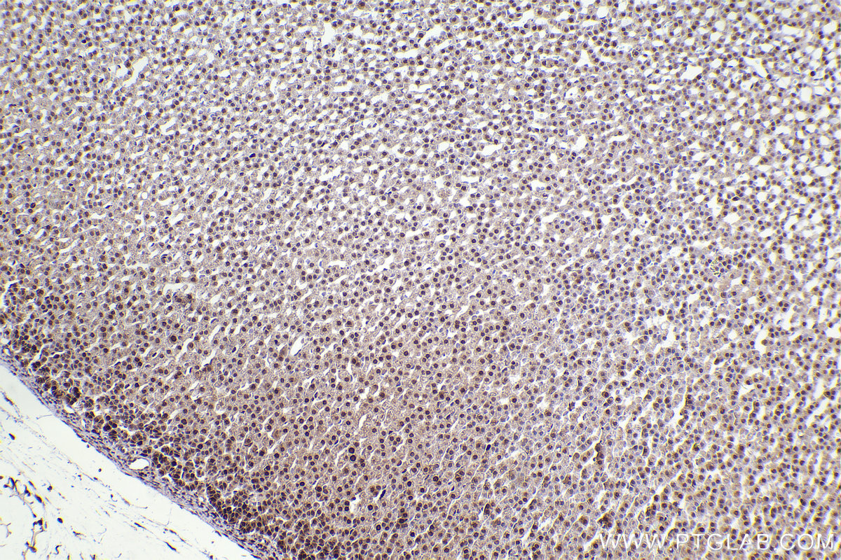 Immunohistochemical analysis of paraffin-embedded rat adrenal gland tissue slide using KHC2424 (ATM IHC Kit).