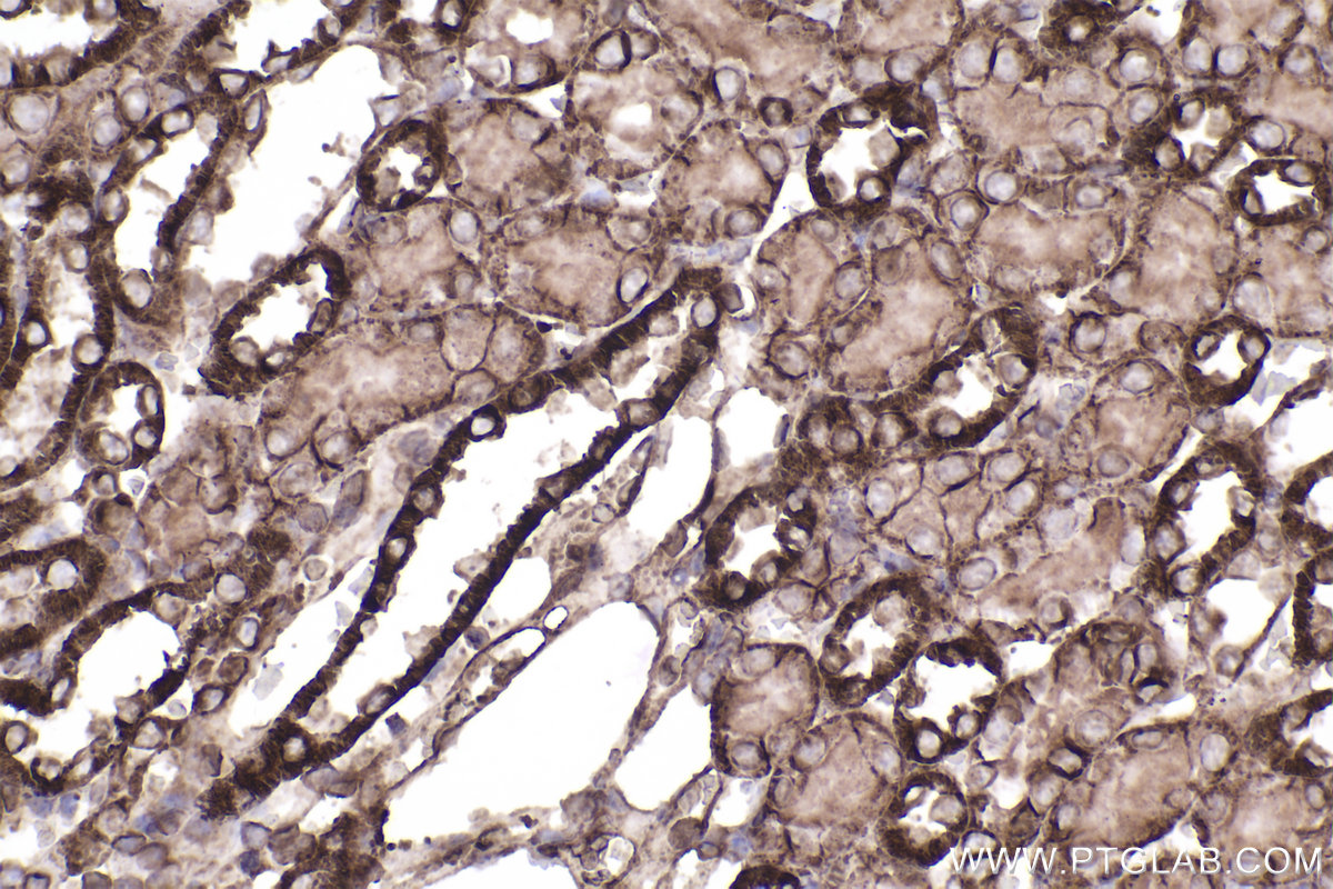 Immunohistochemical analysis of paraffin-embedded mouse kidney tissue slide using KHC2275 (ATP1A1 IHC Kit).