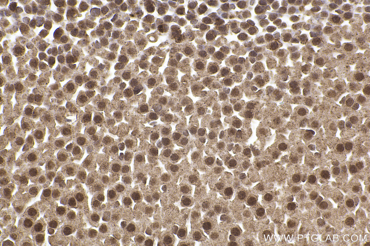 Immunohistochemical analysis of paraffin-embedded mouse adrenal gland tissue slide using KHC2431 (ATR IHC Kit).