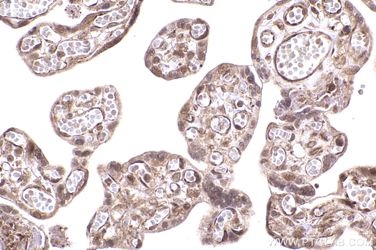 Immunohistochemical analysis of paraffin-embedded human placenta tissue slide using KHC2431 (ATR IHC Kit).