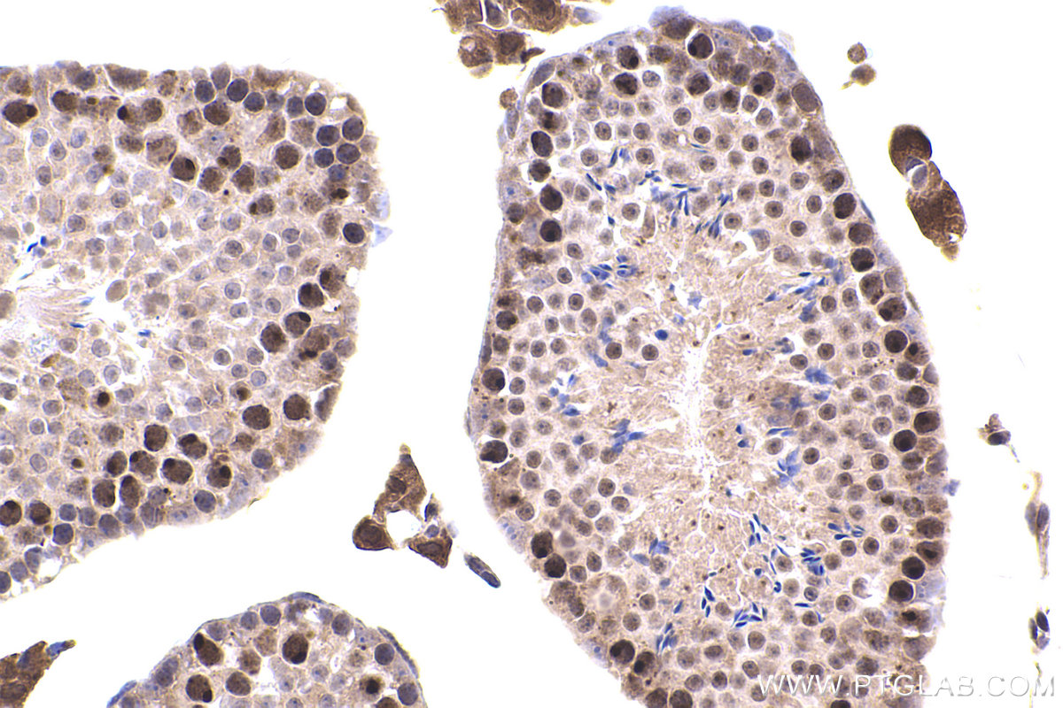 Immunohistochemical analysis of paraffin-embedded mouse testis tissue slide using KHC2431 (ATR IHC Kit).