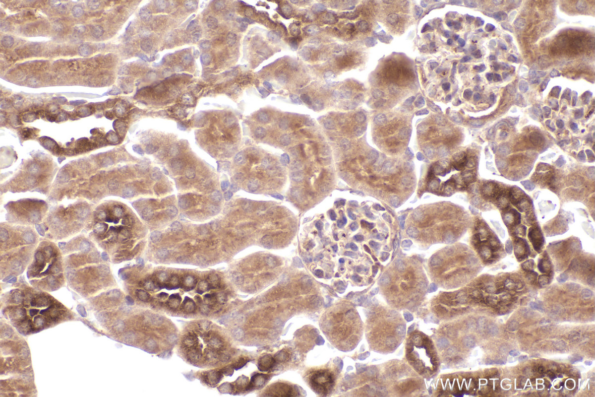 Immunohistochemical analysis of paraffin-embedded mouse kidney tissue slide using KHC2596 (ATRAID/C2orf28 IHC Kit).