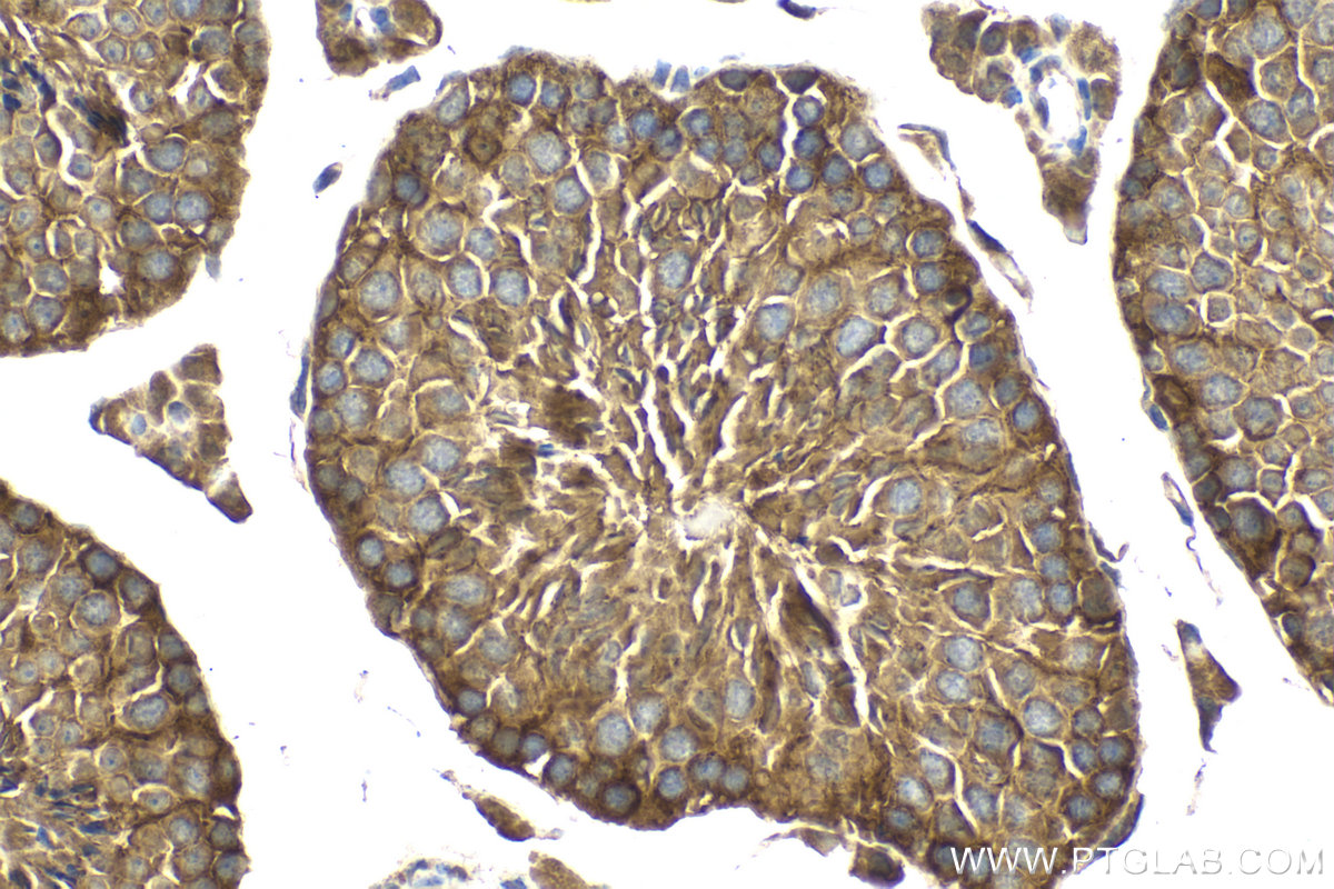 Immunohistochemical analysis of paraffin-embedded mouse testis tissue slide using KHC2148 (BAG2 IHC Kit).