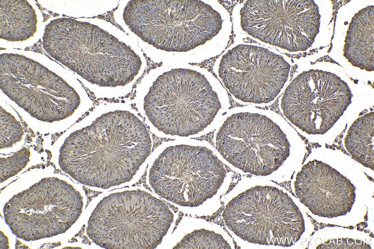 Immunohistochemical analysis of paraffin-embedded rat testis tissue slide using KHC2148 (BAG2 IHC Kit).