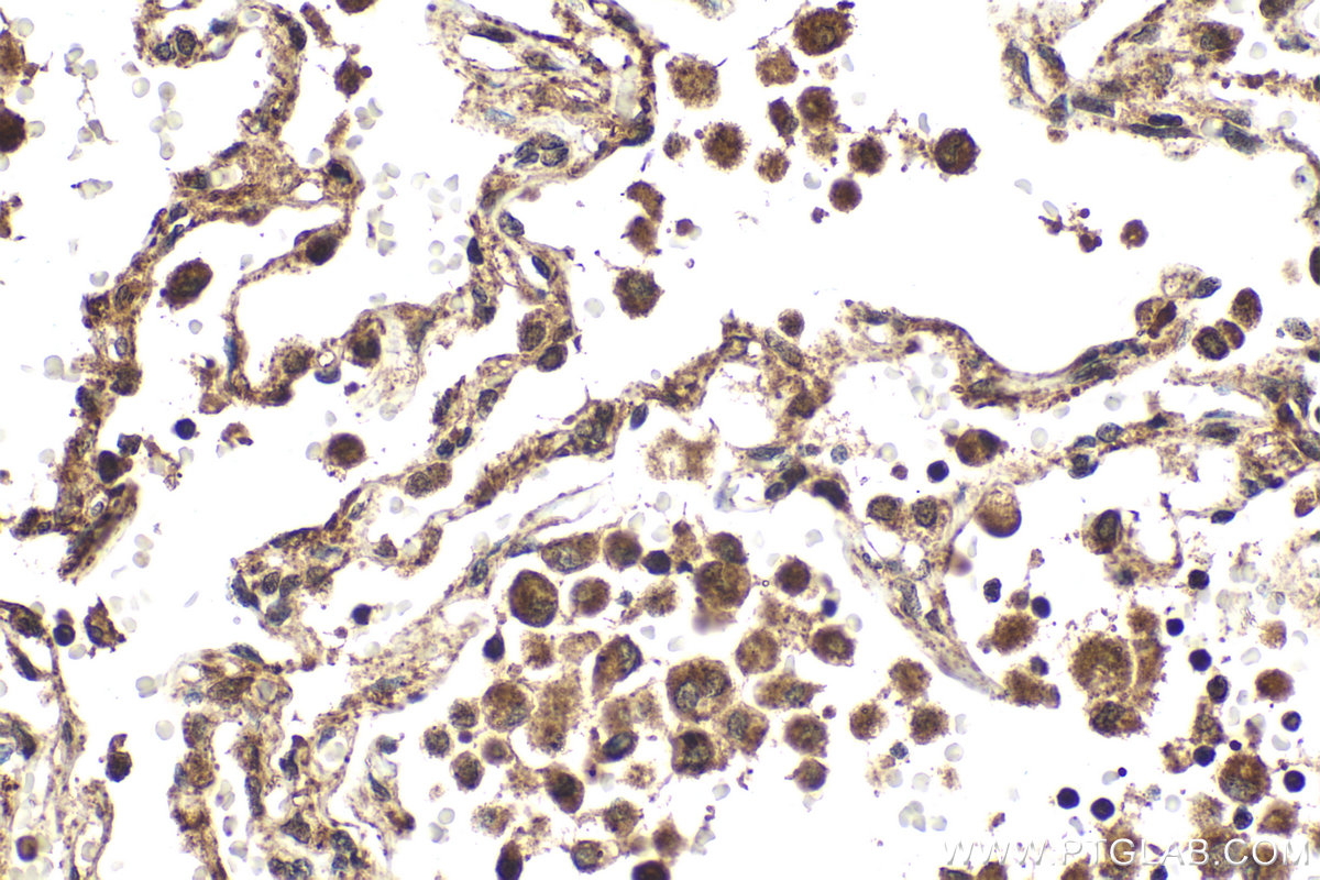 Immunohistochemical analysis of paraffin-embedded human lung tissue slide using KHC2058 (BCKDK IHC Kit).