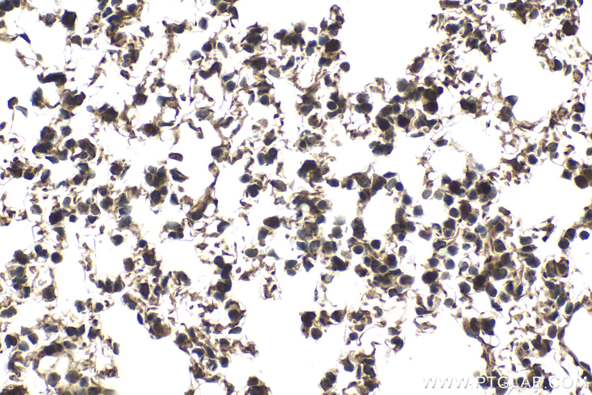 Immunohistochemical analysis of paraffin-embedded mouse lung tissue slide using KHC2058 (BCKDK IHC Kit).