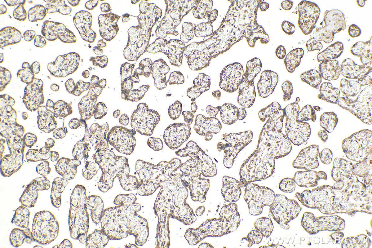 Immunohistochemical analysis of paraffin-embedded human placenta tissue slide using KHC2087 (BCL2L11/BIM IHC Kit).