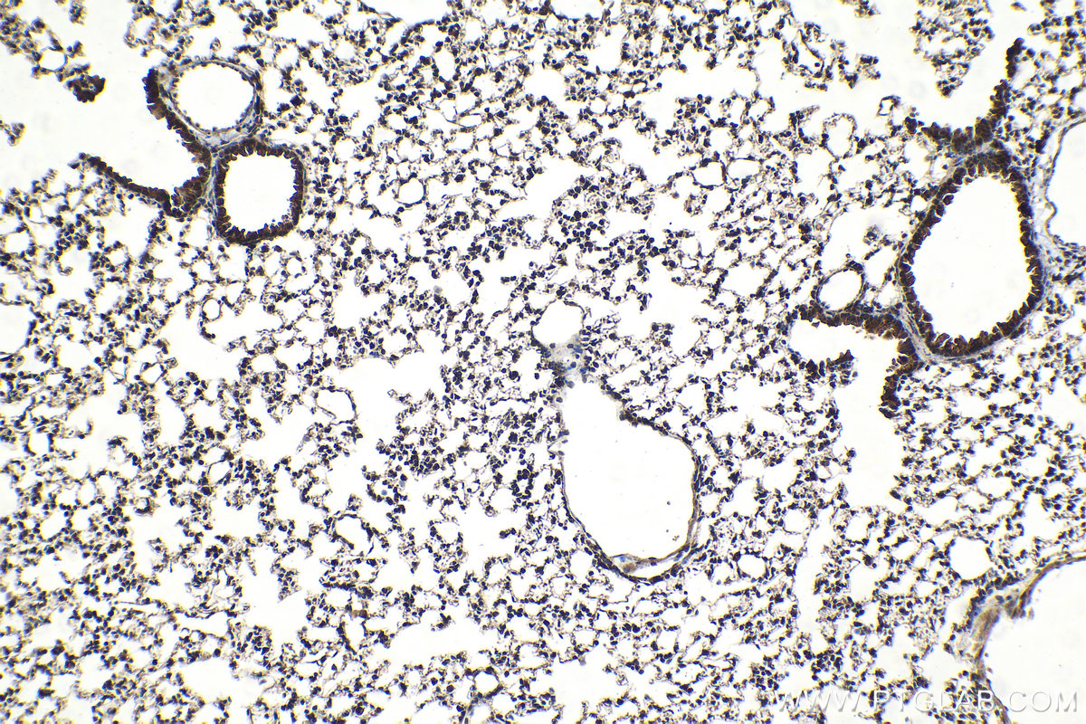 Immunohistochemical analysis of paraffin-embedded mouse lung tissue slide using KHC2087 (BCL2L11/BIM IHC Kit).