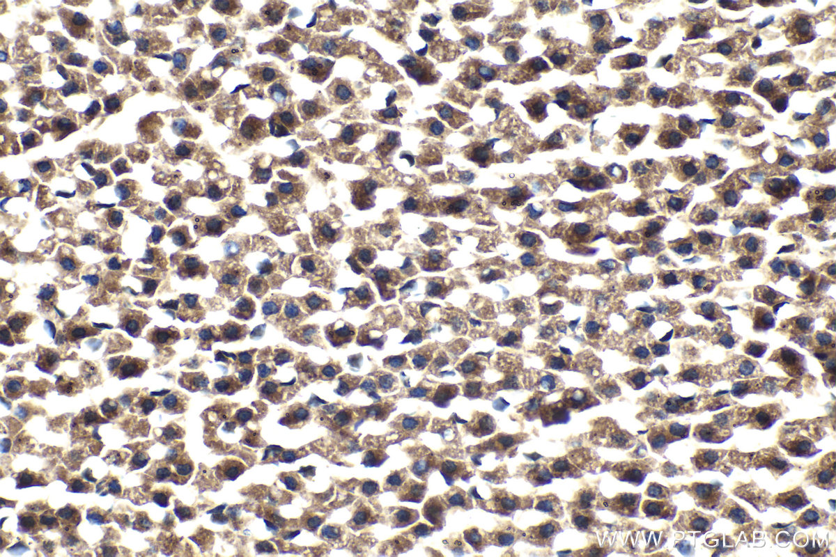 Immunohistochemical analysis of paraffin-embedded rat adrenal gland tissue slide using KHC2087 (BCL2L11/BIM IHC Kit).