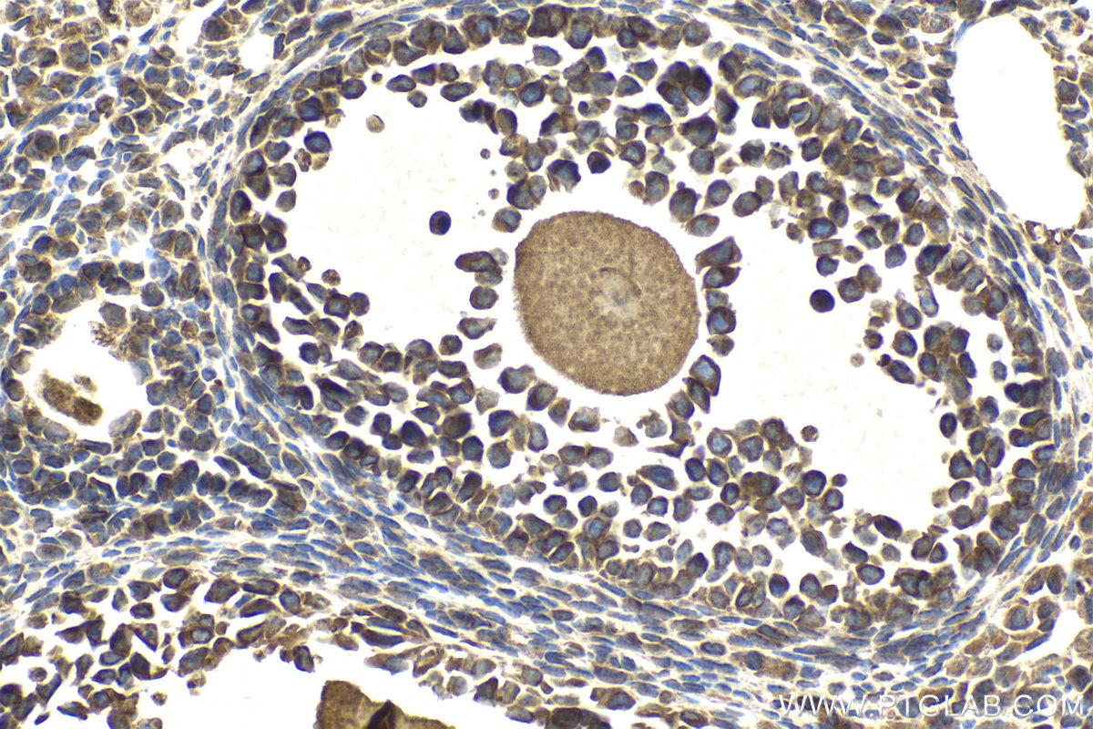 Immunohistochemical analysis of paraffin-embedded mouse ovary tissue slide using KHC2150 (BMP15 IHC Kit).